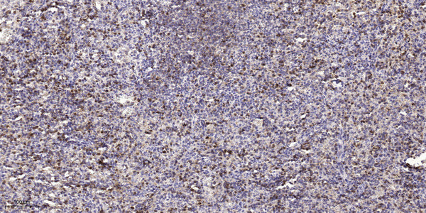 Anti-ASPM antibody (1230-1310 aa) (STJ191769) – Figure 1 of 1