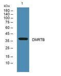 Anti-DMRTB1 antibody (270-350 aa) (STJ191783) – Figure 1 of 1