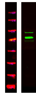Anti-TSPYL2 antibody (STJ191806) – Figure 1 of 1