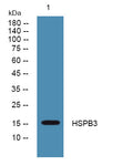 Anti-HSPB3 antibody (30-110 aa) (STJ191855) – Figure 1 of 1
