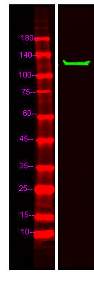 Anti-MIB2 antibody (STJ191914) – Figure 1 of 1