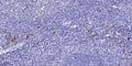 Anti-TNFRSF8 antibody (STJ192014) – Figure 1 of 1