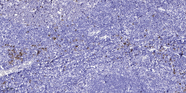 Anti-TNFRSF8 antibody (STJ192014) – Figure 1 of 1