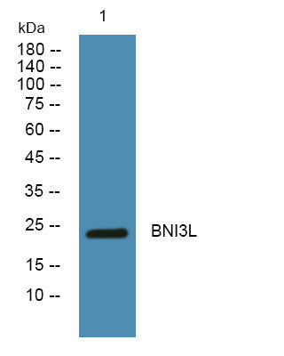 Anti-BNIP3L antibody (STJ192181) – Figure 1 of 1