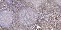 Anti-PTPN13 antibody (STJ192206) – Figure 1 of 1