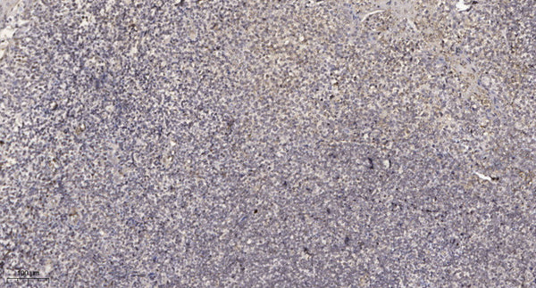Anti-MXRA5 antibody (STJ192207) – Figure 1 of 1