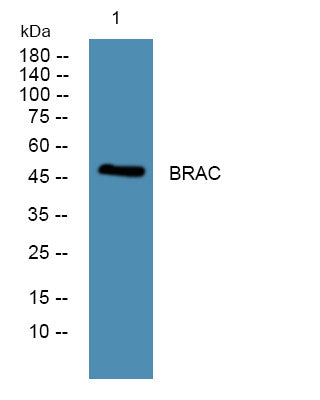 Anti-TBXT antibody (181-230 aa) (STJ192233) – Figure 1 of 1