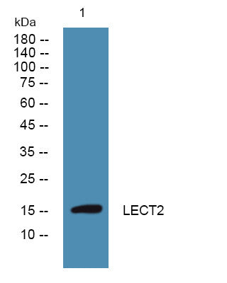 Anti-LECT2 antibody (STJ192308) – Figure 1 of 1
