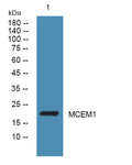 Anti-MCEMP1 antibody (90-170 aa) (STJ192323) – Figure 1 of 1