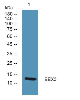 Anti-BEX3 antibody (1-80 aa) (STJ192330) – Figure 1 of 1