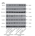 Anti-PLXND1 antibody (170-250 aa) (STJ192394) – Figure 1 of 1