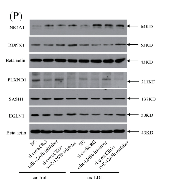 Anti-PLXND1 antibody (170-250 aa) (STJ192394) – Figure 1 of 1