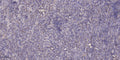 Anti-SACS antibody (4291-4340 aa) (STJ192601) – Figure 1 of 1