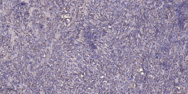 Anti-SACS antibody (4291-4340 aa) (STJ192601) – Figure 1 of 1