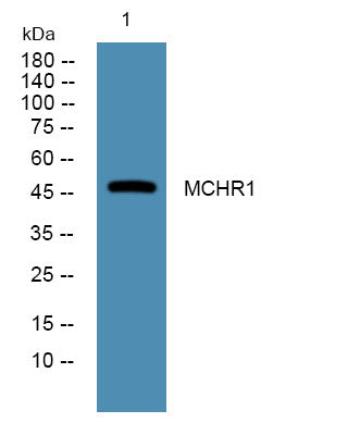 Anti-MCHR1 antibody (STJ192665) – Figure 1 of 1