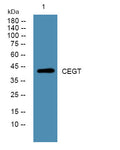 Anti-UGCG antibody (STJ192983) – Figure 1 of 1