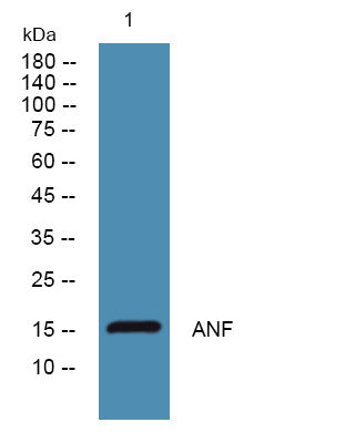 Anti-NPPA antibody (STJ192988) – Figure 1 of 1