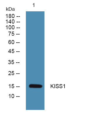 Anti-KISS1 antibody (STJ193006) – Figure 1 of 1