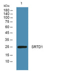 Anti-SERTAD1 antibody (STJ193018) – Figure 1 of 1