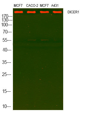 Anti-DICER1 antibody (STJ193053) – Figure 1 of 1
