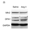 Anti-OPA1 antibody (STJ193080) – Figure 1 of 1