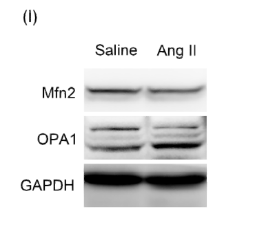 Anti-OPA1 antibody (STJ193080) – Figure 1 of 1