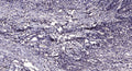 Anti-PCNT antibody (STJ193082) – Figure 1 of 1