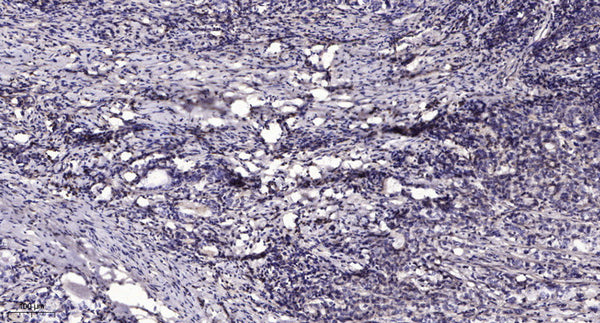 Anti-PCNT antibody (STJ193082) – Figure 1 of 1