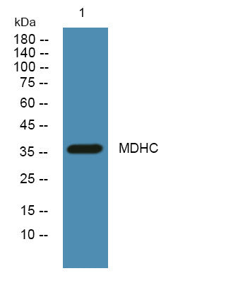 Anti-MDH1 antibody (STJ193110) – Figure 1 of 1