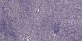 Anti-IDH2 antibody (STJ193148) – Figure 1 of 1