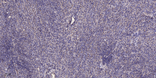 Anti-IDH2 antibody (STJ193148) – Figure 1 of 1