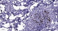 Anti-COLQ antibody (STJ193151) – Figure 1 of 1