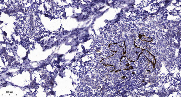 Anti-COLQ antibody (STJ193151) – Figure 1 of 1