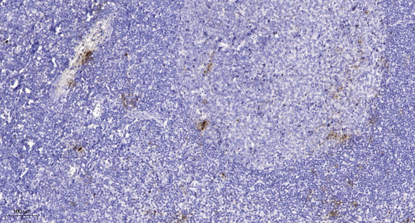 Anti-SLC6A4 antibody (STJ193156) – Figure 1 of 1