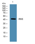 Anti-KCNJ6 antibody (STJ193158) – Figure 1 of 1
