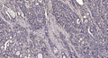 Anti-FKBP1A/B antibody (26-75 aa) (STJ193162) – Figure 1 of 1