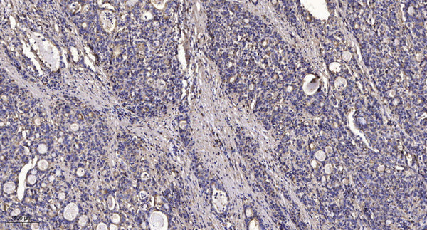 Anti-FKBP1A/B antibody (26-75 aa) (STJ193162) – Figure 1 of 1