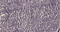 Anti-ITK antibody (450-530 aa) (STJ193205) – Figure 1 of 1