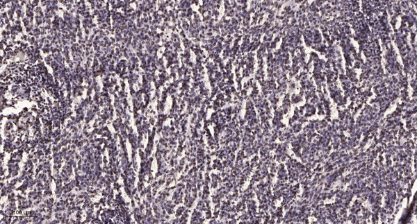 Anti-ITK antibody (450-530 aa) (STJ193205) – Figure 1 of 1