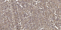 Anti-Phospho-GRK2-Tyr86 antibody (STJ193211) – Figure 1 of 1