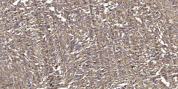 Anti-Phospho-GRK2-Tyr86 antibody (STJ193211) – Figure 1 of 1