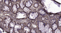 Anti-Phospho-EGFR-Tyr998 antibody (STJ193217) – Figure 1 of 1