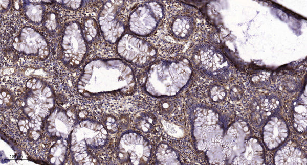 Anti-Phospho-EGFR-Tyr998 antibody (STJ193217) – Figure 1 of 1