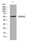 Anti-SLC11A2 antibody (474-524 aa) (STJ193616) – Figure 1 of 1