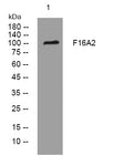 Anti-FHIP1B antibody (430-480 aa) (STJ193748) – Figure 1 of 1