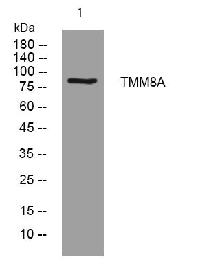 Anti-PGAP6 antibody (647-697 aa) (STJ193802) – Figure 1 of 1
