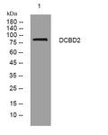Anti-DCBLD2 antibody (142-192 aa) (STJ193819) – Figure 1 of 1