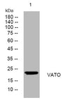 Anti-ATP6V0B antibody (149-199 aa) (STJ193834) – Figure 1 of 1