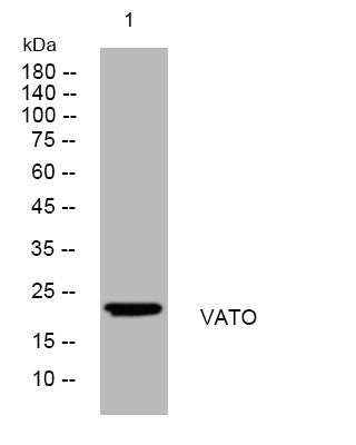 Anti-ATP6V0B antibody (149-199 aa) (STJ193834) – Figure 1 of 1