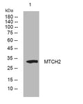 Anti-MTCH2 antibody (59-109 aa) (STJ193838) – Figure 1 of 1